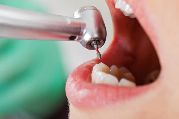 Best Emergency Treatment for Toothache in Gore, OK